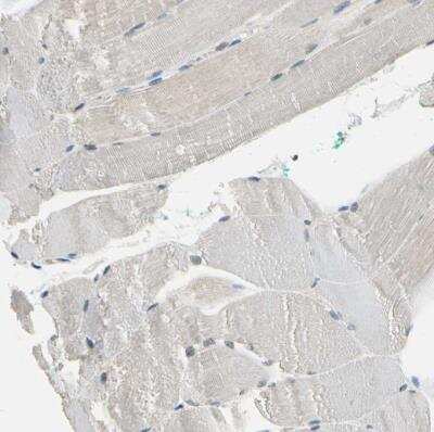 Immunohistochemistry-Paraffin: NFATC2/NFAT1 Antibody [NBP1-82583]