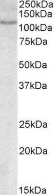 Western Blot: NFATC2/NFAT1 Antibody [NBP1-51970]