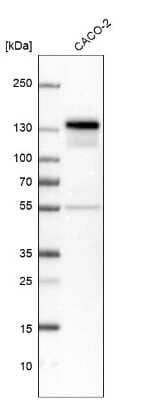 Western Blot: NFATC2/NFAT1 Antibody [NBP1-82583]