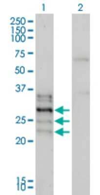 Western Blot: NFATC2IP Antibody (2D7-A10) [H00084901-M01]