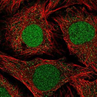 Immunocytochemistry/ Immunofluorescence: NFATC2IP Antibody [NBP2-58210]