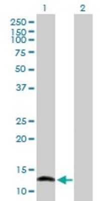 Western Blot: NFATC2IP Antibody [H00084901-B01P]