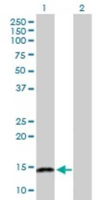 Western Blot: NFATC2IP Antibody [H00084901-D01P]