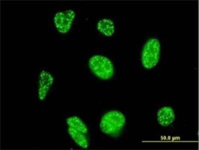 Immunocytochemistry/ Immunofluorescence: NFATC3/NFAT4 Antibody (3A12) [H00004775-M02]