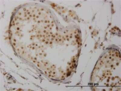 Immunohistochemistry-Paraffin: NFATC3/NFAT4 Antibody (3A12) [H00004775-M02]