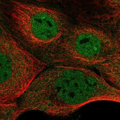 Immunocytochemistry/ Immunofluorescence: NFATC3/NFAT4 Antibody [NBP2-58079]