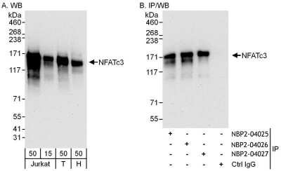 Immunoprecipitation: NFATC3/NFAT4 Antibody [NBP2-04025]