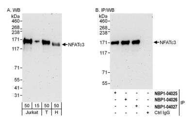 Western Blot: NFATC3/NFAT4 Antibody [NBP2-04027]