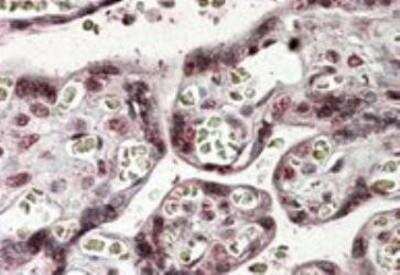 Immunohistochemistry-Paraffin: NFATC4 Antibody [NB100-1082]