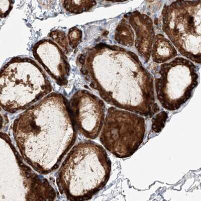 Immunohistochemistry-Paraffin: NFATC4 Antibody [NBP1-82585]