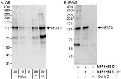 Western Blot: NFATC4 Antibody [NBP1-46210]