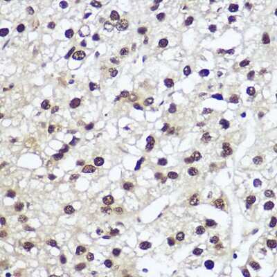 Immunohistochemistry-Paraffin: NFIA Antibody - BSA Free [NBP2-94656]