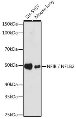 Western Blot: NFIB Antibody (7T1G5) [NBP3-16757]