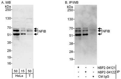 Immunoprecipitation: NFIB Antibody [NBP2-04121]