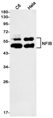 Western Blot: NFIB Antibody (S03-0E5) [NBP3-19716]