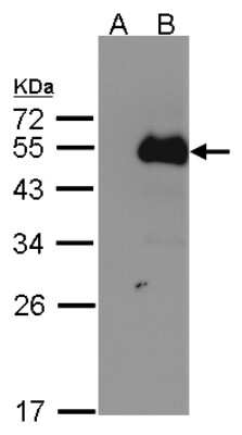 Western Blot: NFIB Antibody [NBP2-19526]