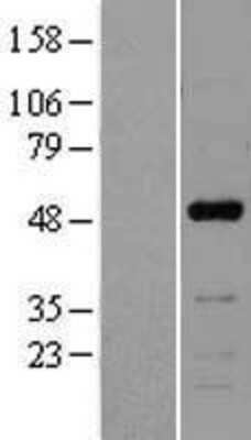 Western Blot: NFIB Overexpression Lysate [NBL1-13616]