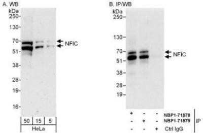 Western Blot: NFIC Antibody [NBP1-71878]