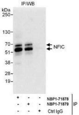 Western Blot: NFIC Antibody [NBP1-71879]