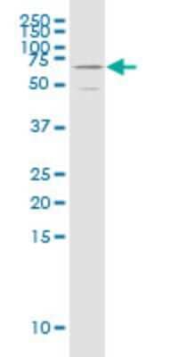 Western Blot: NFIX Antibody (3D2) [H00004784-M08]