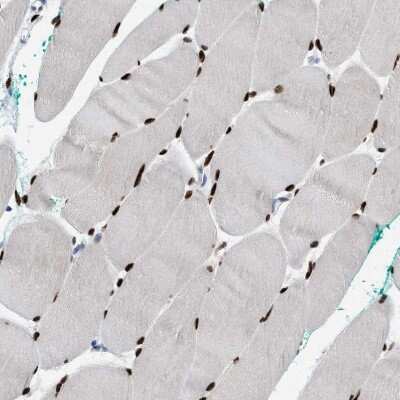 Immunohistochemistry-Paraffin: NFIX Antibody [NBP2-58904]