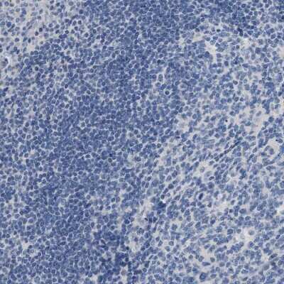 Immunohistochemistry-Paraffin: NFIX Antibody [NBP2-58904]