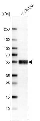 Western Blot: NFIX Antibody [NBP2-58904]