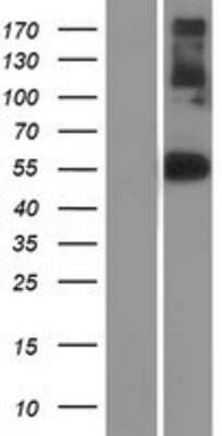 Western Blot: NFIX Overexpression Lysate [NBP2-08108]