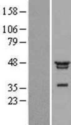 Western Blot: NFKBIL1 Overexpression Lysate [NBL1-13622]