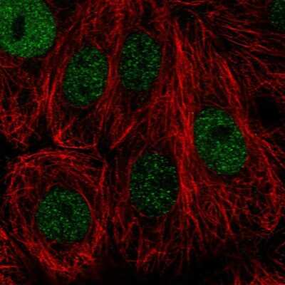 Immunocytochemistry/ Immunofluorescence: NFKBIL2 Antibody [NBP1-87764]