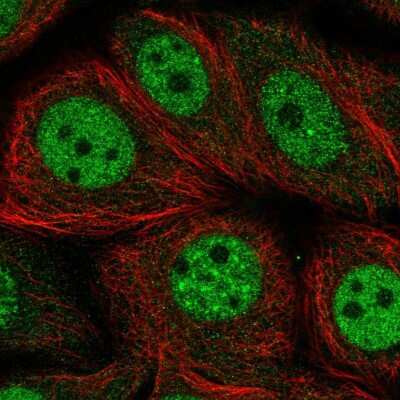 Immunocytochemistry/ Immunofluorescence: NFKBIL2 Antibody [NBP2-48847]