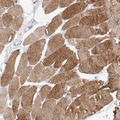 Immunohistochemistry-Paraffin: NFKBIL2 Antibody [NBP1-87764]