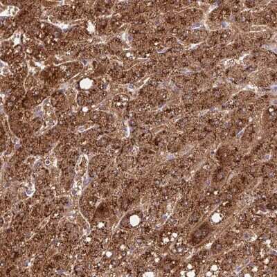 Immunohistochemistry-Paraffin: NFKBIL2 Antibody [NBP2-48847]