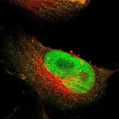 Immunocytochemistry/ Immunofluorescence: NFRKB Antibody [NBP1-85096]