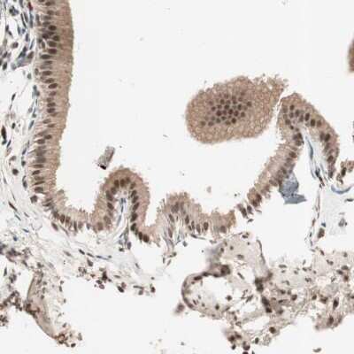 Immunohistochemistry-Paraffin: NFRKB Antibody [NBP1-85095]