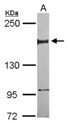 Western Blot: NFRKB Antibody [NBP2-19532]