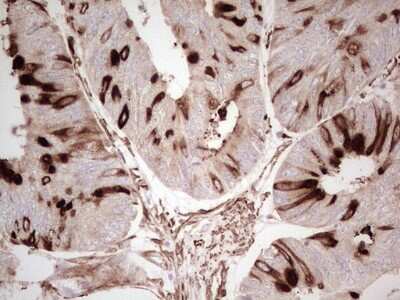 Immunohistochemistry: NFS1 Antibody (OTI2H5) [NBP2-46161]