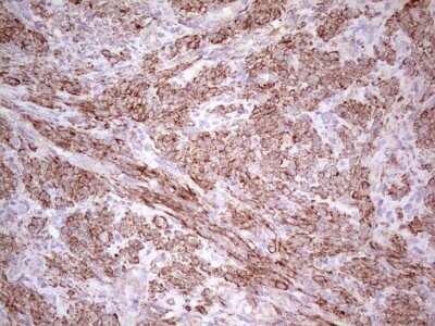 Immunohistochemistry: NFS1 Antibody (OTI2H5) [NBP2-46161]