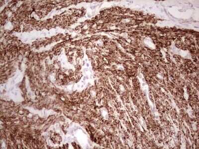 Immunohistochemistry: NFS1 Antibody (OTI2H5) [NBP2-46161]