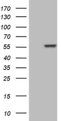 Western Blot: NFS1 Antibody (OTI2H5) [NBP2-46161]