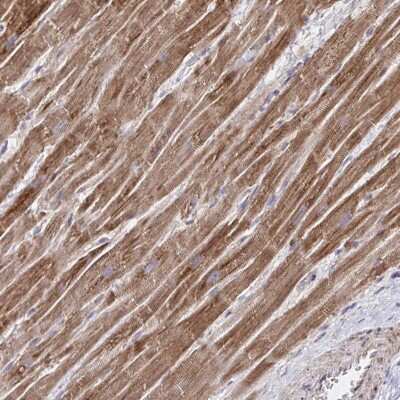 Immunohistochemistry: NFS1 Antibody [NBP2-37933]