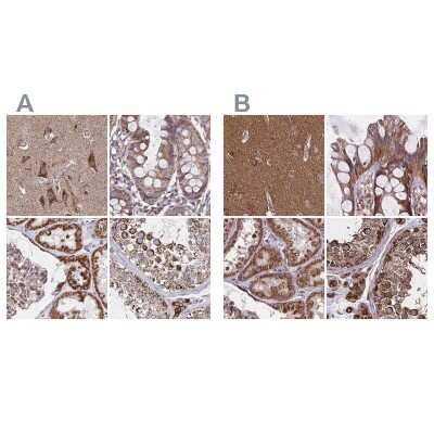 Immunohistochemistry-Paraffin: NFS1 Antibody [NBP2-37933]