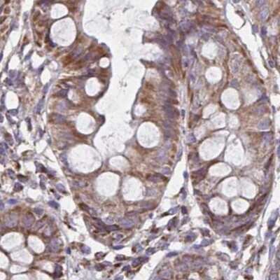 Immunohistochemistry-Paraffin: NFS1 Antibody [NBP2-37933]