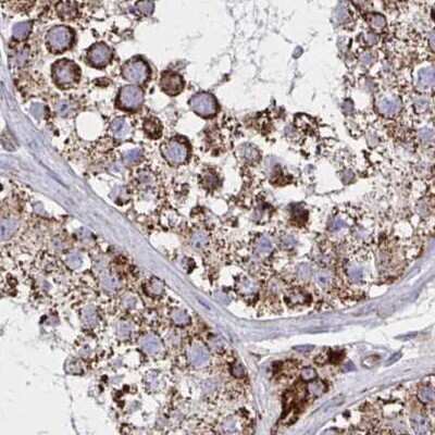 Immunohistochemistry-Paraffin: NFS1 Antibody [NBP2-37933]