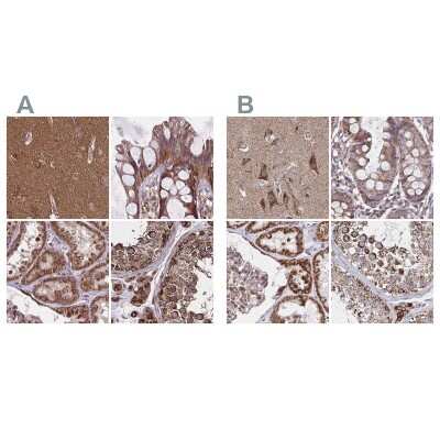 Immunohistochemistry-Paraffin: NFS1 Antibody [NBP2-38737]