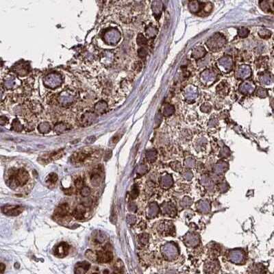 Immunohistochemistry-Paraffin: NFS1 Antibody [NBP2-38737]