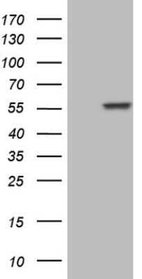 Western Blot: NFS1 Antibody (OTI2H5)Azide and BSA Free [NBP2-72978]