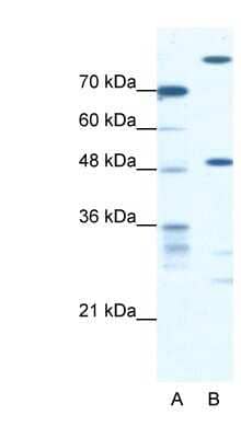 Western Blot: NFS1 Antibody [NBP1-54685]