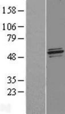 Western Blot: NFS1 Overexpression Lysate [NBL1-13625]