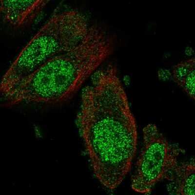 Immunocytochemistry/ Immunofluorescence: NFX1 Antibody [NBP2-57148]